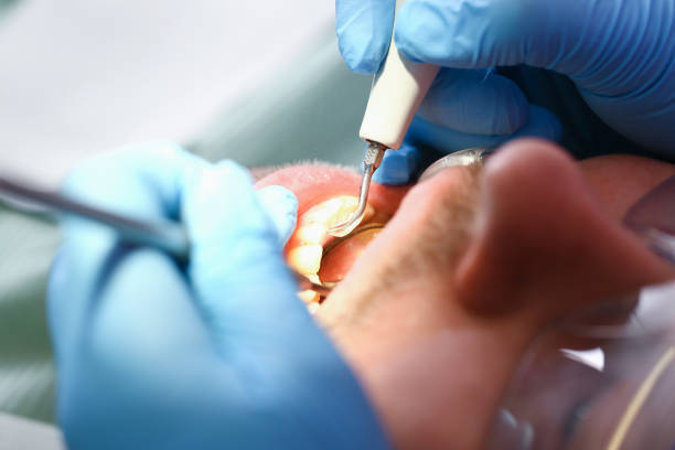 Best Chipped Tooth Repair Near Me  in Eden Isle, LA