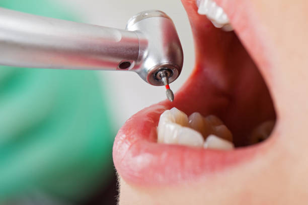 Best Tooth Infection Emergency Dentist  in Eden Isle, LA